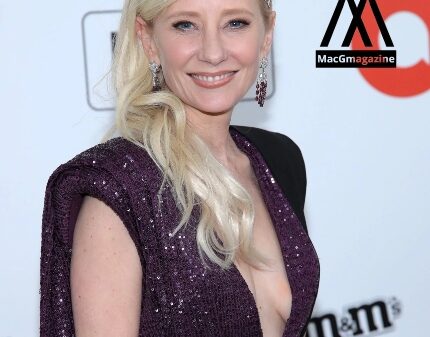 Anne Heche is dead after crashing her BMW in a building